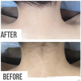 美肌脱毛フェイシャル サロンAMOのエステ・リラクイメージ