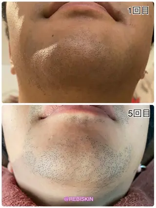 【痩身・脱毛サロン】 REBISKIN🌱のエステ・リラクイメージ