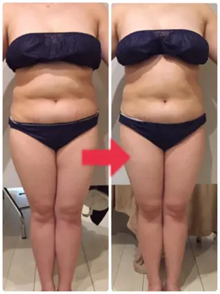 ショート カラー パーマ ヘアアレンジ メンズ キッズ ネイル マツエク・マツパ ‍痩身＆ボディ 結果出し🌟丹野のエステ・リラクイメージ