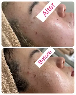 サロンドチェリー 《我妻》のエステ・リラクイメージ