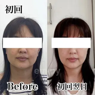 小顔と ヘッドスパのお店のエステ・リラクイメージ