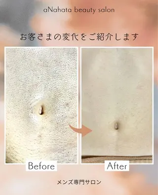 メンズ aNahata beauty salon所属・田中 菜月のエステ・リラクイメージ