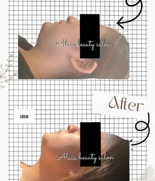 Alaia beau ty salonのエステ・リラクイメージ