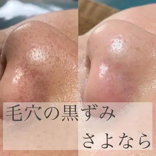 eyelashsalon Plaisir所属・ツカハラ ミカのエステ・リラクイメージ