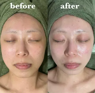 【肌質改善サロン】 リーフィアのエステ・リラクイメージ