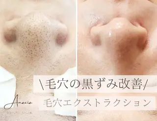 Anacia Beauty Salon所属・美肌脱毛&毛穴専門 Anaciaのエステ・リラクイメージ