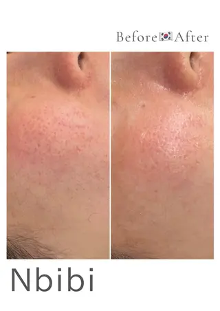 韓国🇰🇷価格 サロン_Nbibiのエステ・リラクイメージ