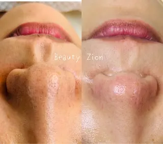 Beauty Zion所属・Beauty Zionのエステ・リラクイメージ