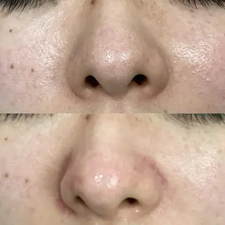 美肌専門サロン RUBONのエステ・リラクイメージ