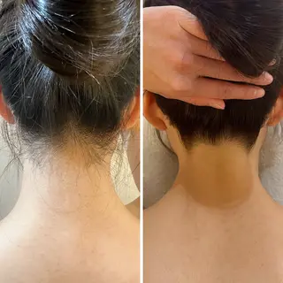 うなじ脱毛/美肌脱毛 LABELのエステ・リラクイメージ