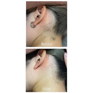 メルシー13所属・トータル美容サロン☆ 脱毛/小顔/毛穴洗浄のエステ・リラクイメージ