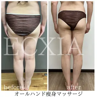 ECXIA 【エクシア】のエステ・リラクイメージ