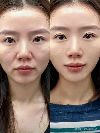 ネイル aliaハイフ&水光ジェットサロン所属・aliaハーブ水光店 エステティシャン募集のエステ・リラクイメージ