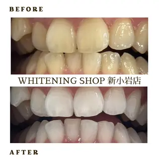 メンズ ホワイトニング ショップ新小岩店のその他イメージ