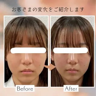 小顔矯正＆美肌サロン ブプラ大元駅前店のエステ・リラクイメージ