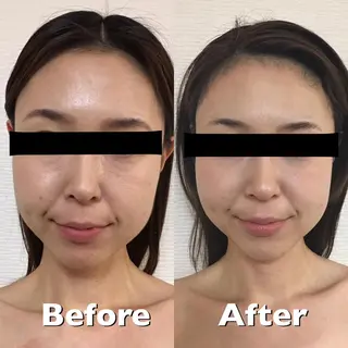 小顔筋膜矯正サロン桜Biscuit~サクラビスケット~所属・小顔/肩こり/脱毛 桜Bisucuitのエステ・リラクイメージ