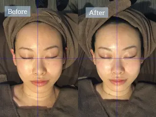 肌質改善専門店 Re.terna田辺のエステ・リラクイメージ