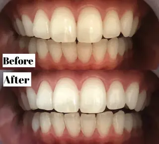 LBS吉祥寺 公式のエステ・リラクイメージ