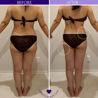 小顔＆まつ毛サロン AKANE❤️のエステ・リラクイメージ