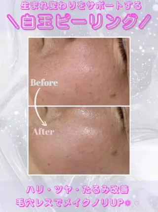 レイビス盛岡店 ♡吉田♡のエステ・リラクイメージ