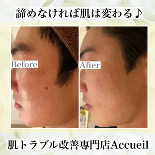 ミディアム カラー パーマ ヘアアレンジ メンズ キッズ ネイル マツエク・マツパ ニキビ・肌質改善専門 ♡人生が変わるサロンのエステ・リラクイメージ