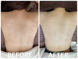 ハーブピーリング 横浜のエステ・リラクイメージ