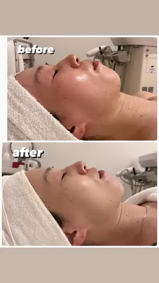 POLA THE BEAUTY 堺東店所属・肌管理🌿毛穴改善 POLA堺東のエステ・リラクイメージ