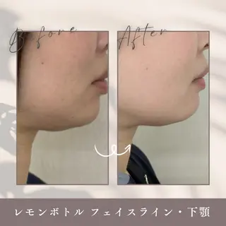 ResetLab 佐藤 風香のエステ・リラクイメージ