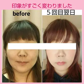 小顔と美肌 まごころエステMatoria所属・小顔 美肌専門 Matoriaのエステ・リラクイメージ