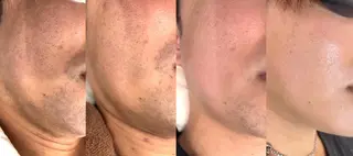 都度払い脱毛 BARNEYのエステ・リラクイメージ