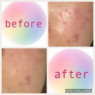 ミディアム カラー パーマ ヘアアレンジ メンズ キッズ ネイル マツエク・マツパ ニキビ・肌質改善専門 ♡人生が変わるサロンのエステ・リラクイメージ