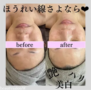 beautysalonW所属・beauty salonWのエステ・リラクイメージ