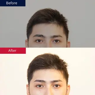 メンズ アイブロウ プラスエイト渋谷店所属・無料メンズアイブロウ モデル募集中の眉毛・アイブロウイメージ