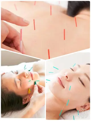 小顔矯正・美容鍼 美鍼堂のエステ・リラクイメージ