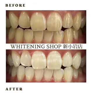 メンズ ホワイトニング ショップ新小岩店のその他イメージ