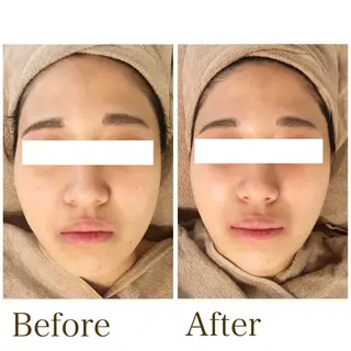 MiMiy 銀座店のエステ・リラクイメージ