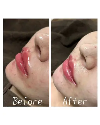 肌質改善Charme coco  増毛のエステ・リラクイメージ