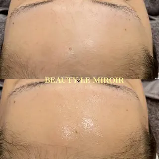 ビューティー ミロワールのエステ・リラクイメージ