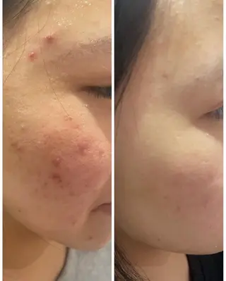 Sena Dewi所属・Sena Dewi 🫧Ayakaのエステ・リラクイメージ