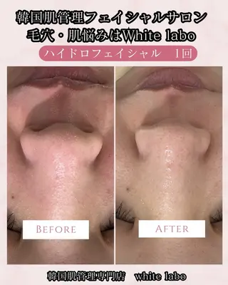韓国肌管理専門店　White labo 梅田店所属・ホワイトラボ梅田 ｜毛穴・韓国肌管理のエステ・リラクイメージ