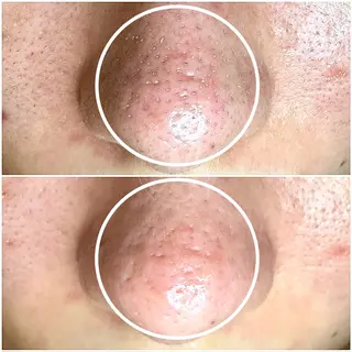 salon de beauté More所属・More 大阪福島区 毛穴・肌質改善のエステ・リラクイメージ