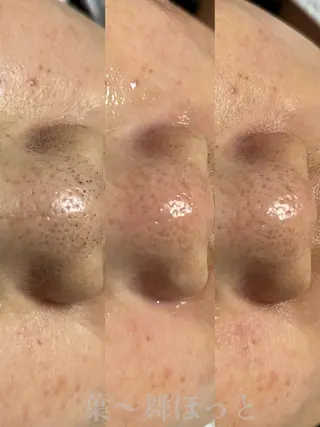 うえつま ふみえのエステ・リラクイメージ