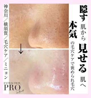 Mignon +所属・Mignon + Natsukiのマツエク・マツパデザイン