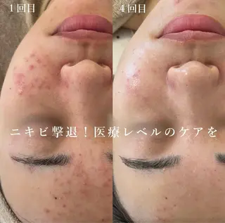 blan. beauty salon所属・blan. /岡本/ 神戸ハーブピーリングのエステ・リラクイメージ