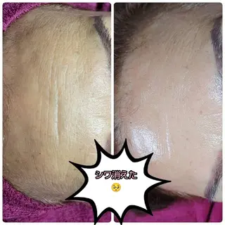 viage所属・viage 脱毛&フェイシャル店のエステ・リラクイメージ