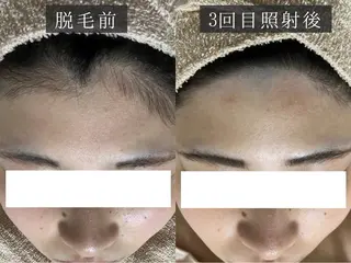 脱毛専門サロン BELFINE恵比寿のエステ・リラクイメージ