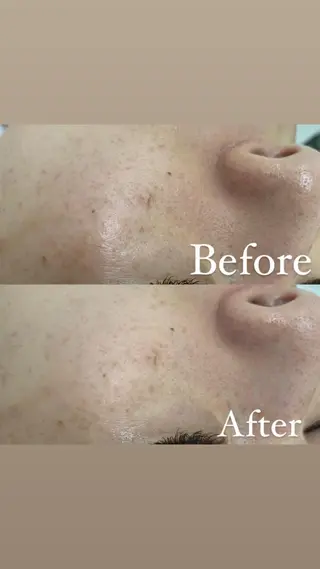 デ・アイム新潟　　北所属・山口 萌のエステ・リラクイメージ