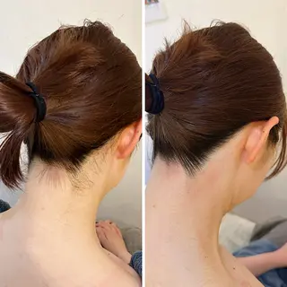 うなじ脱毛/美肌脱毛 LABELのエステ・リラクイメージ