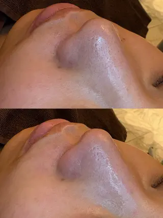 EARTH coiffure beaute 新潟紫竹山店所属・🤍アベシュリ /フェイシャル🤍のエステ・リラクイメージ