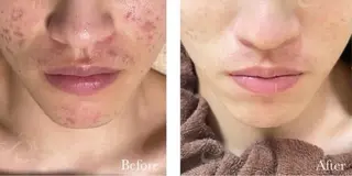 salon merci和泉のエステ・リラクイメージ